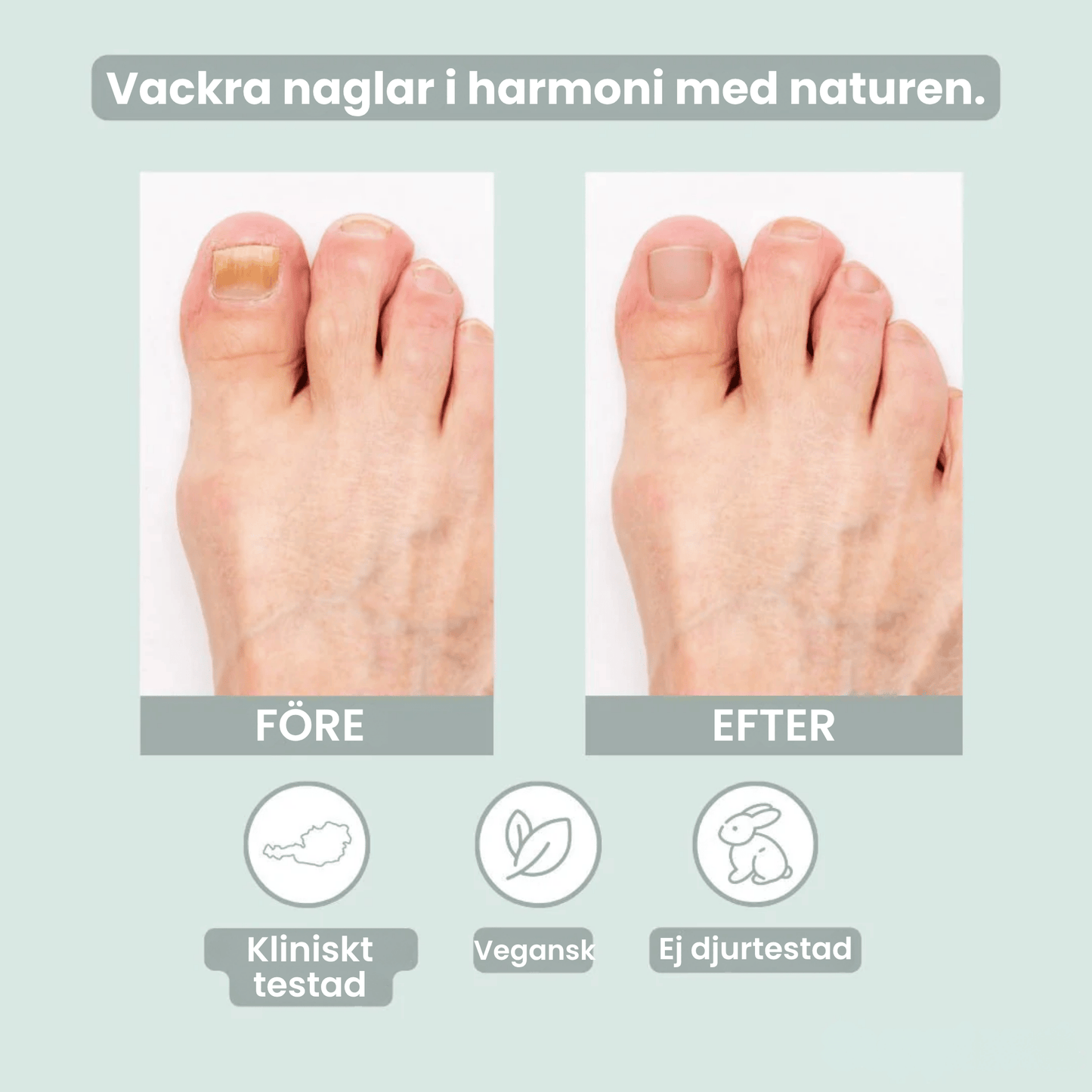 NagelRen - Din lösning mot nagelsvamp